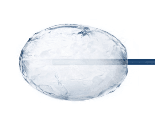 Cryo S Painless - bedste prober til cryobehandling