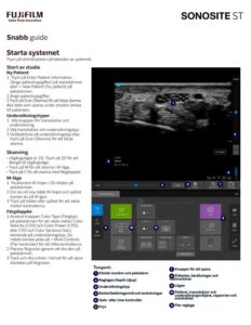 Sonosite ST snabb guide för ultraljudsskanning