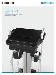 Sonosite ZX ultraljudsapparat som kan användas till ett flertal applikationer 