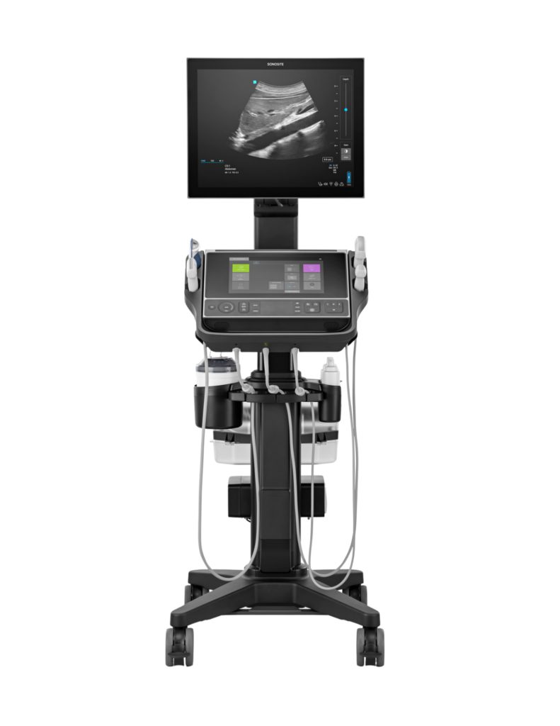 Ultralydsscanner Sonosite LX Secma