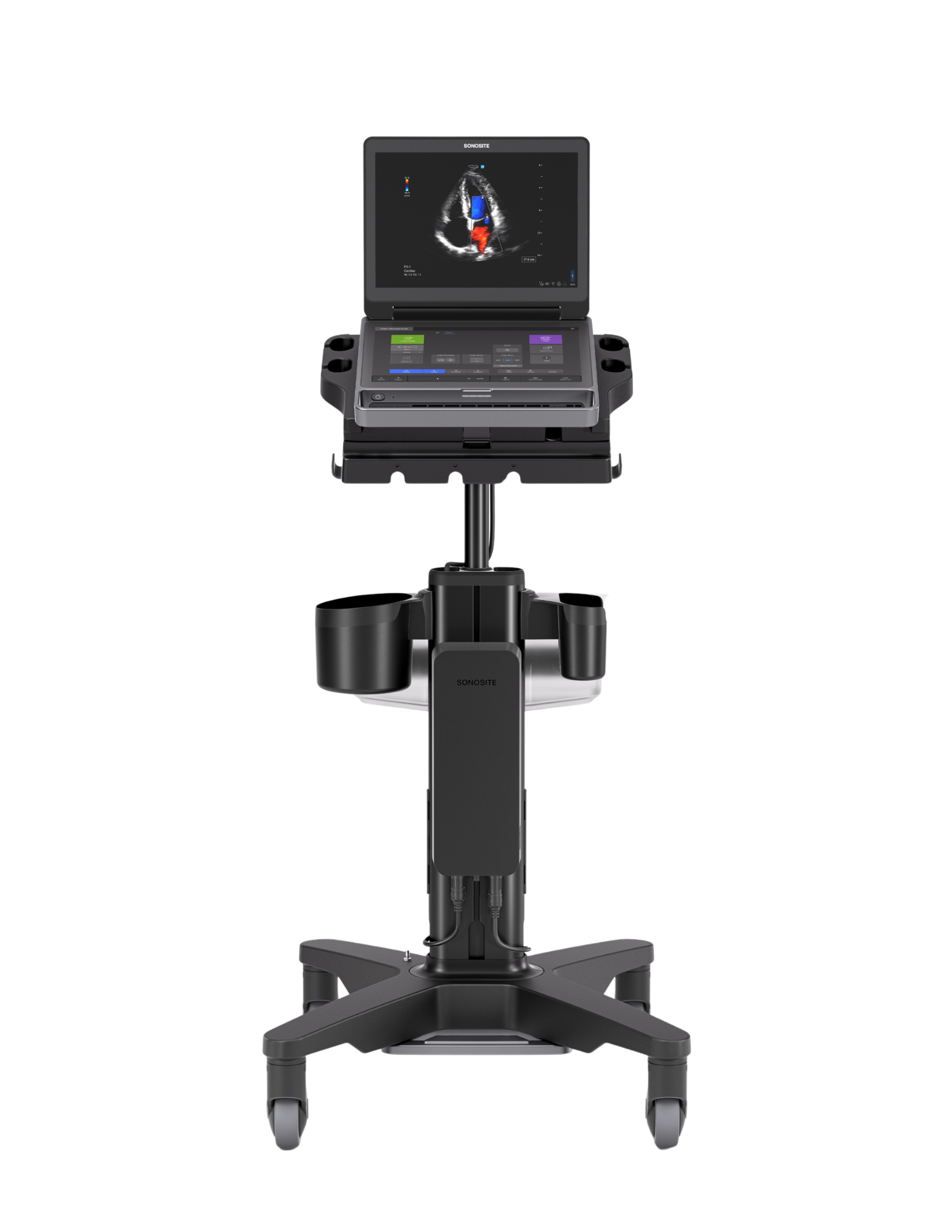 Ultralydsscanner Sonosite MT Secma
