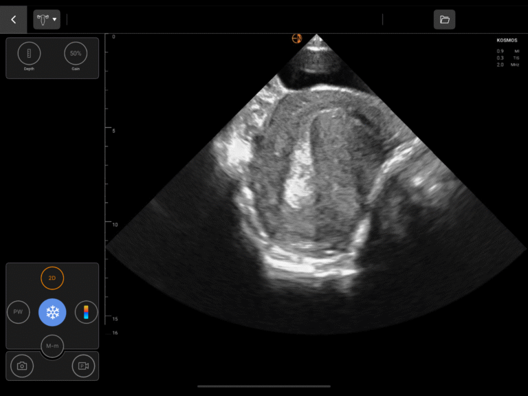 GYN-Retroverted-Uterus-768x576